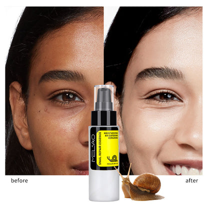 Snail Skin Care Facial Care Solution - FlawlessFinds